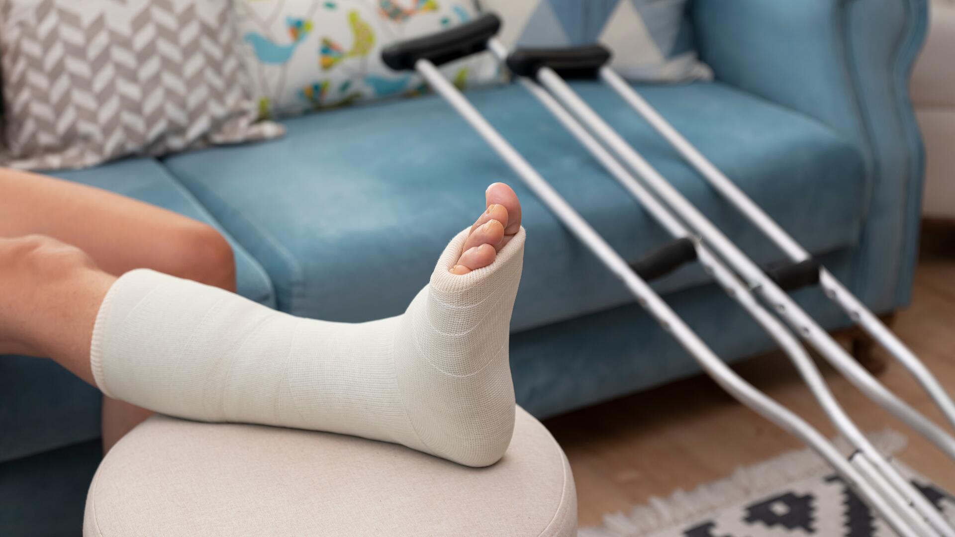 En person har gipset beinet og hviler med krykker ved siden av på en blå sofa.