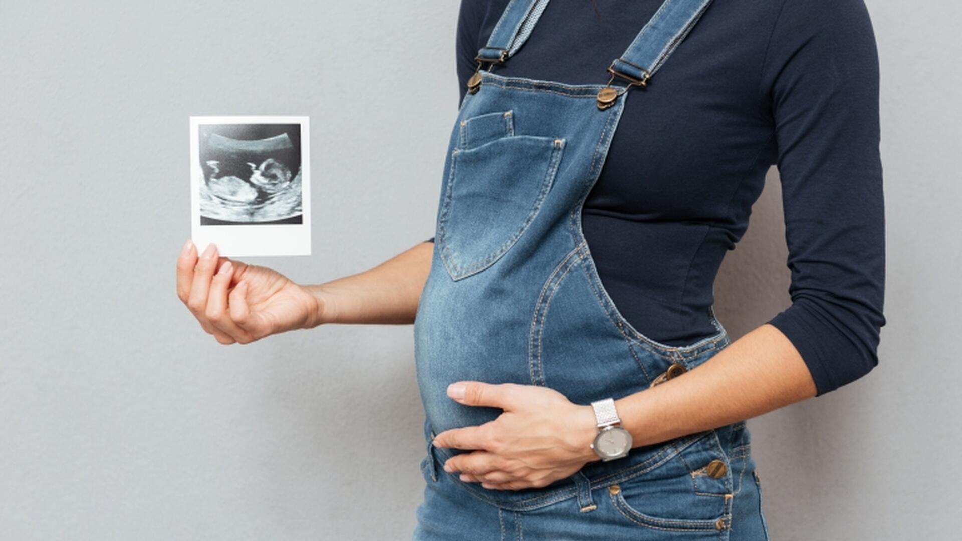 Gravid med røntgenbilde