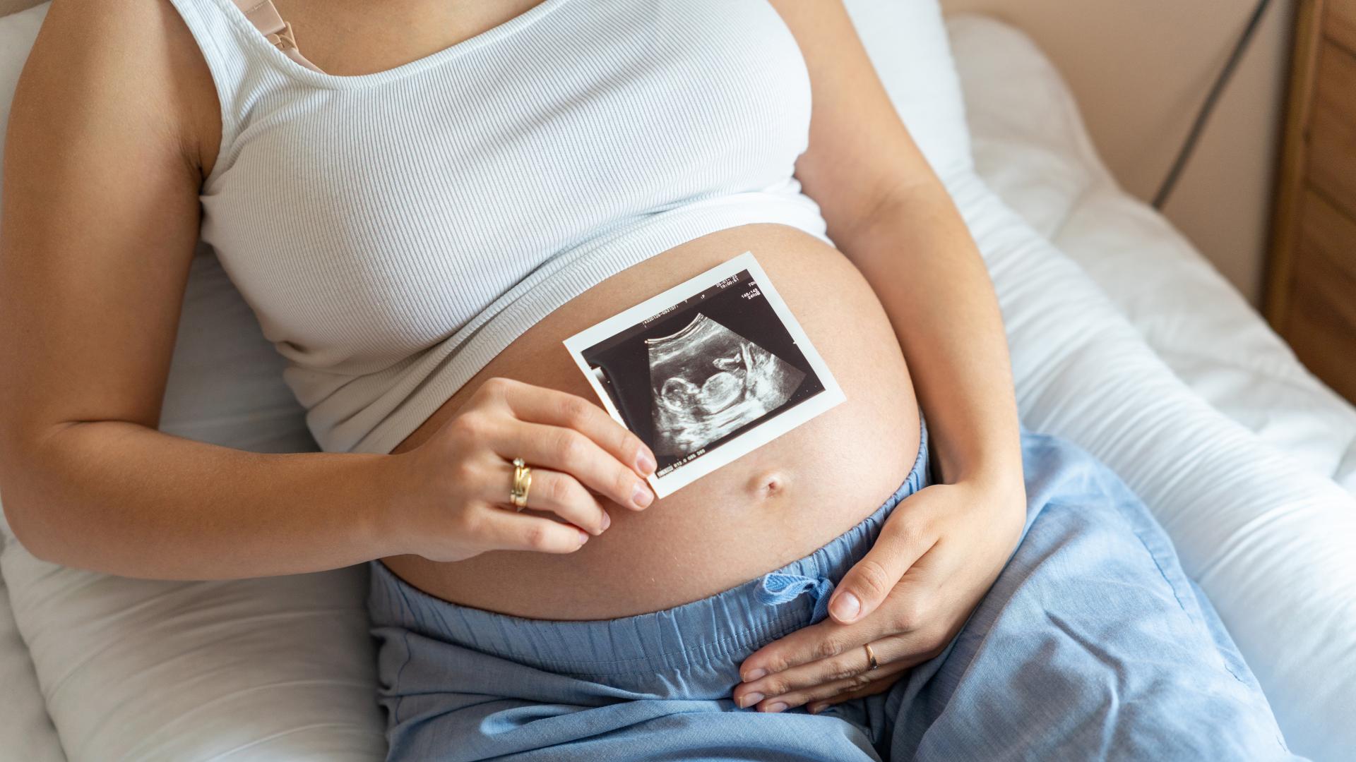 Utsnitt av gravid kvinne, hun holder ultralydbilde i ene hånden, og andre hånden på magen